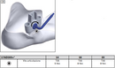 Estribo / Foot Stirrup para 17AD300 - OTTOBOCK