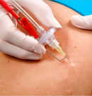 Ares Carboxiterapia com Gás Aquecido e Corrente High Volt - Ibramed