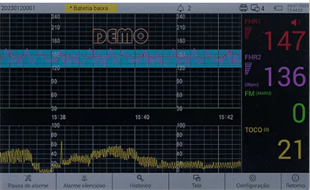 Graf Monitor Cardiotocógrafo Monitor Fetal MF 9200 B - Cardiotocografia Computadori