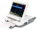 Cardiotocógrafo Monitor Fetal MF 9200 Plus - Cardiotocografia Computadorizada - MEDPEJ