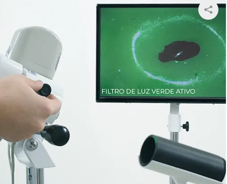 Colposcópio Binocular de Aumento Fixo em 16x com Câmera, 5 Rodízios e Braço Articulável - PE 7000 FBRDC - MEDPEJ