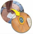Dispositivo de Feedback RCP – DEA Alive - CMOS DRAKE