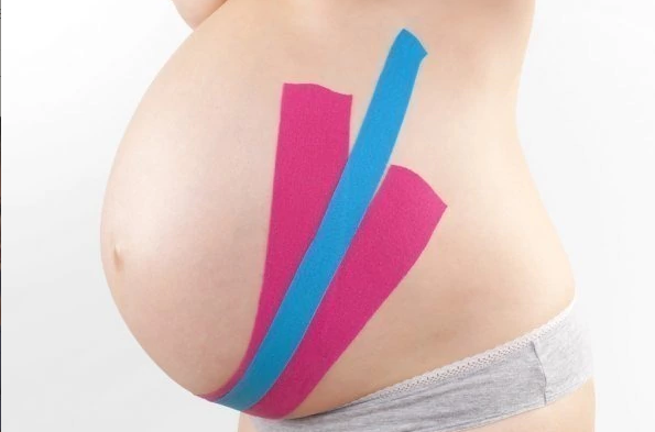 FITA KINÉSIO TAPE BANDAGEM ELÁSTICA KELOGEL PREMIUM 5CMX5M 1UN - MEDFORMA