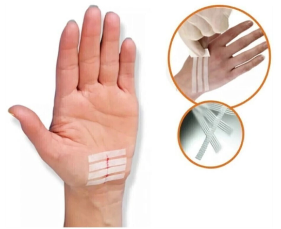 KELOGEL STRIP SUTURA CUTÂNEA ADESIVA COM 10 TIRAS 6MMx100MM - MEDFORMA