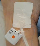 Kit Descartável de Terapia por Pressão Negativa a Vácuo (Durabilidade 15 dias) - Marca RECO - ENVIO IMEDIATO