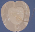 Curativos extriCARE® - Sistema de Terapia de Feridas por Pressão Negativa - Extricare