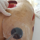 O Curativo a Vácuo para Tratamento de Feridas Por Pressão Negativa TopiVac Classic